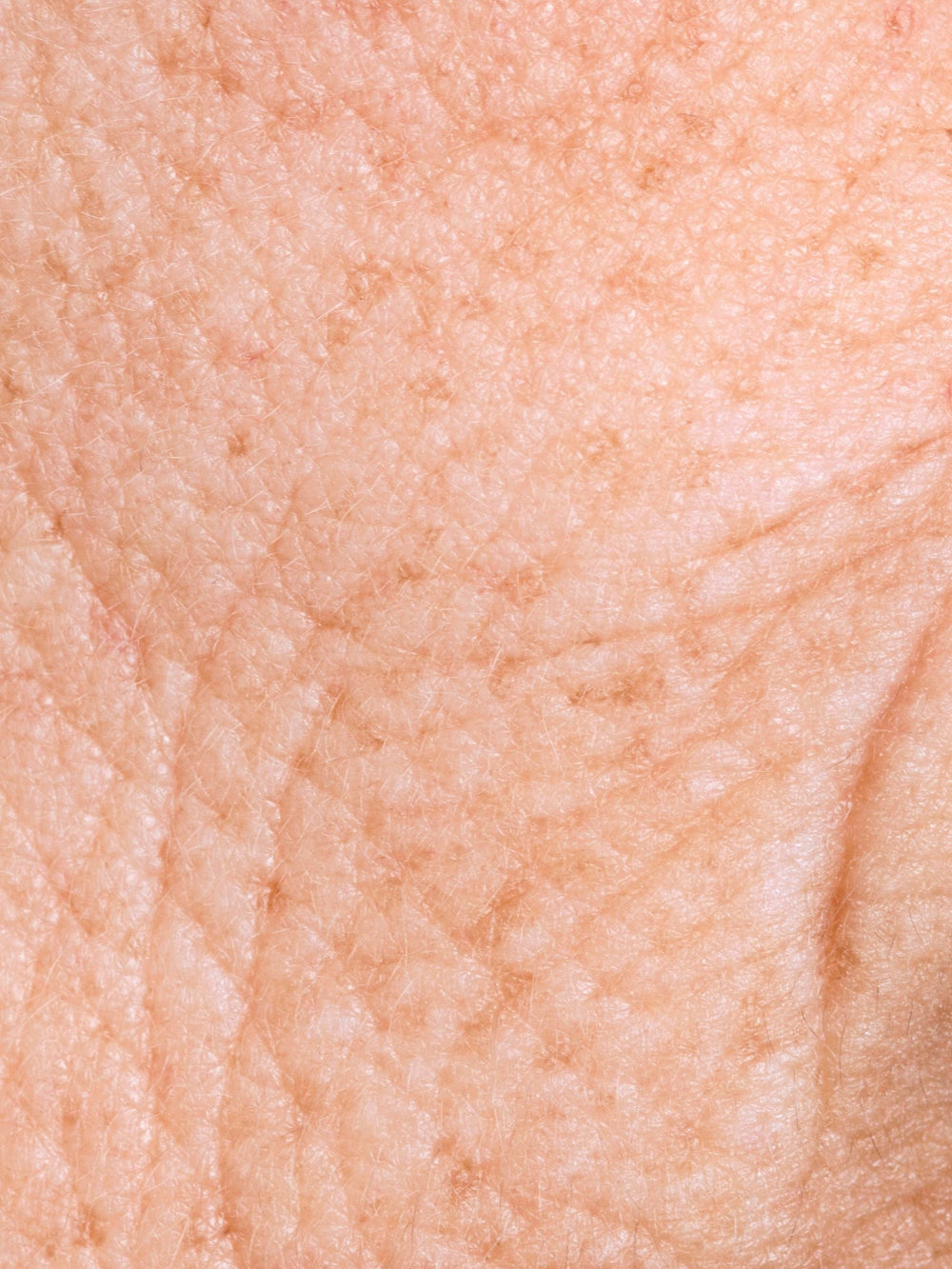 aging & first wrinkles