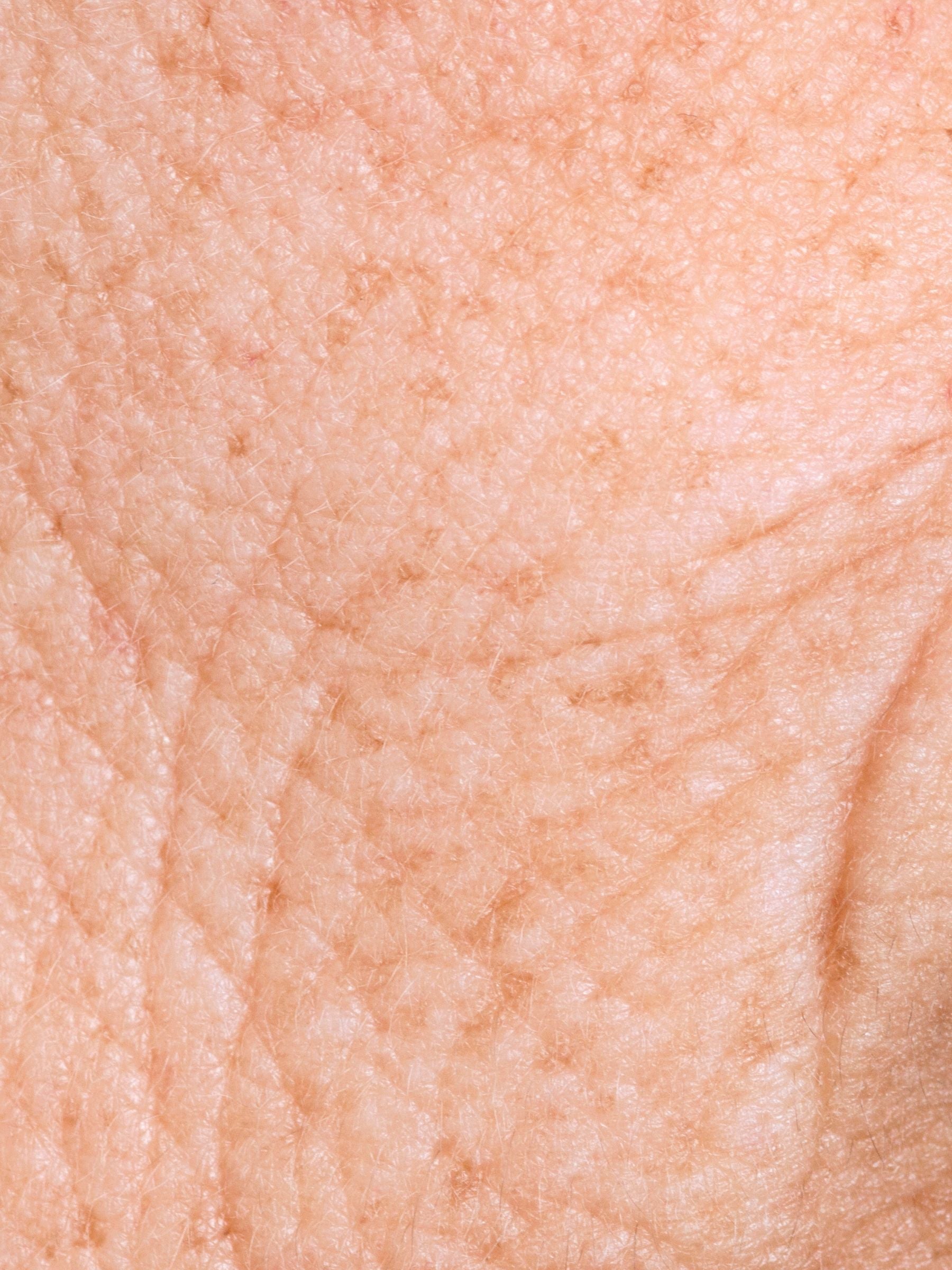 aging & first wrinkles